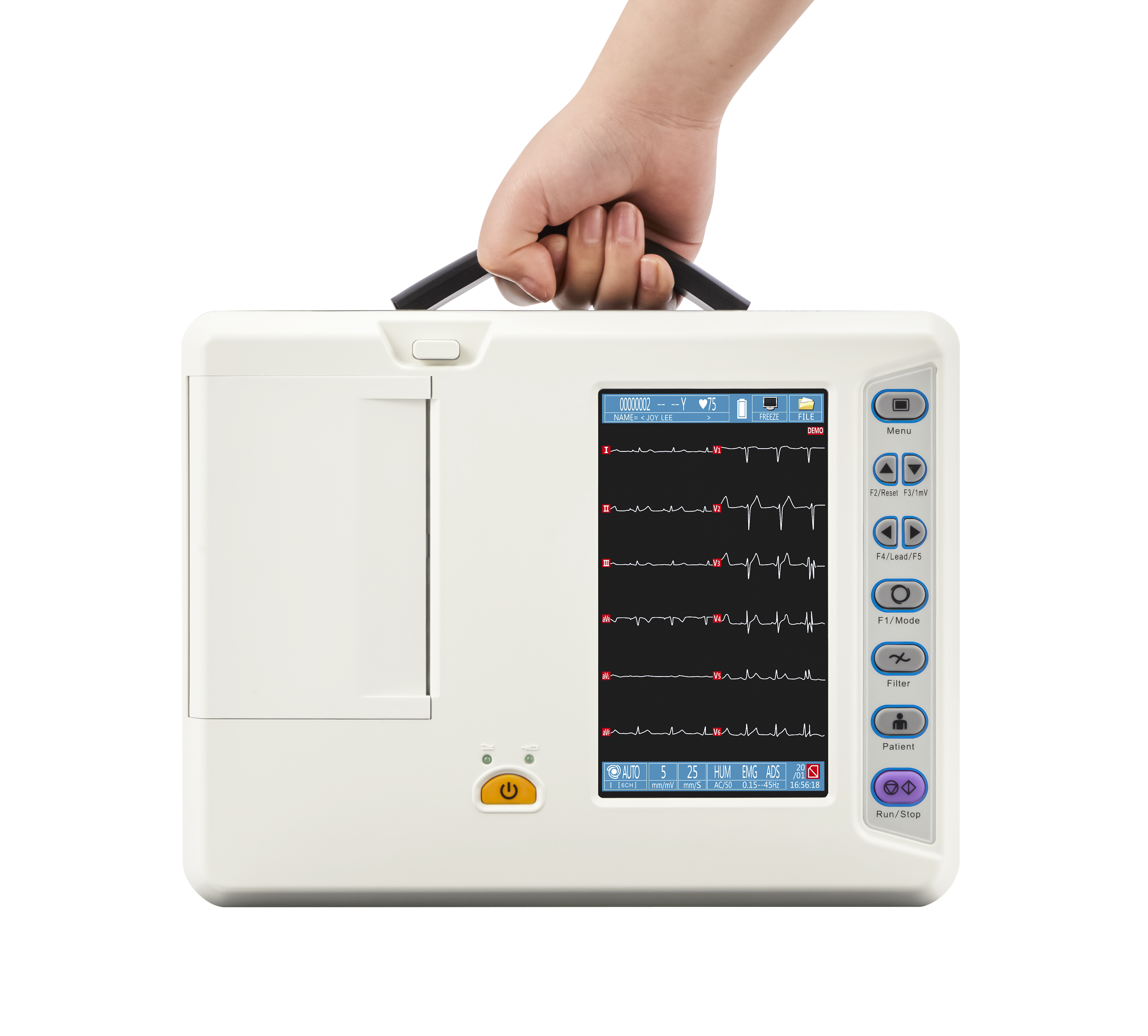 Electrocardi&oacute;grafo de 6 derivaciones-8