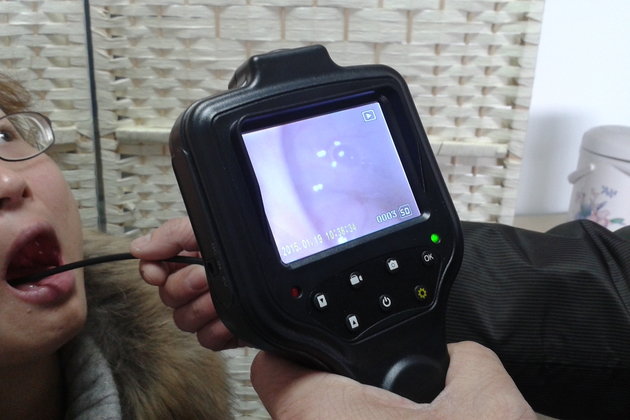 Otoscopio digital port&aacute;til-2