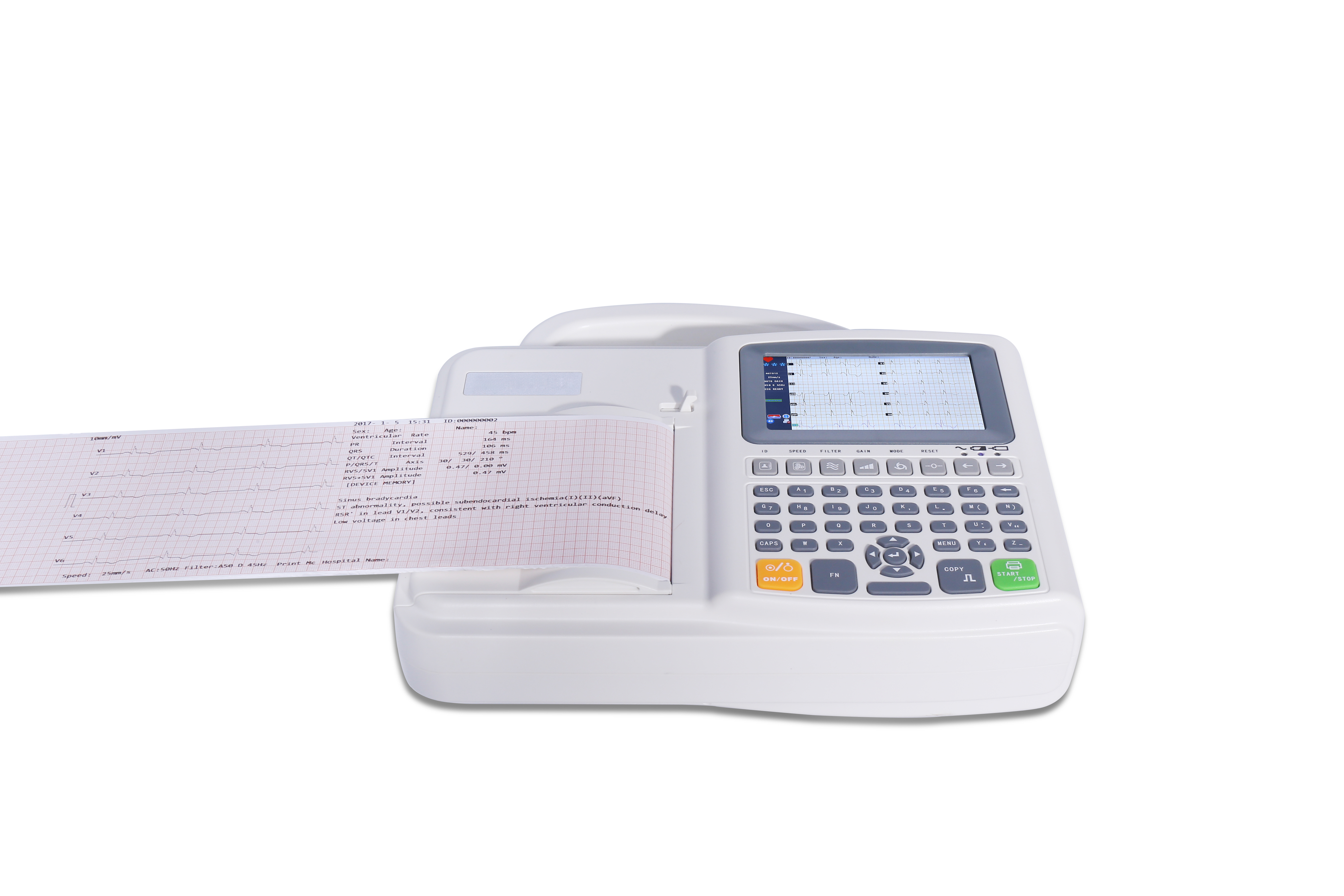 M&aacute;quina monitor ECG/EKG de 6 canales 12 derivaciones con pantalla LCD color TFT-2