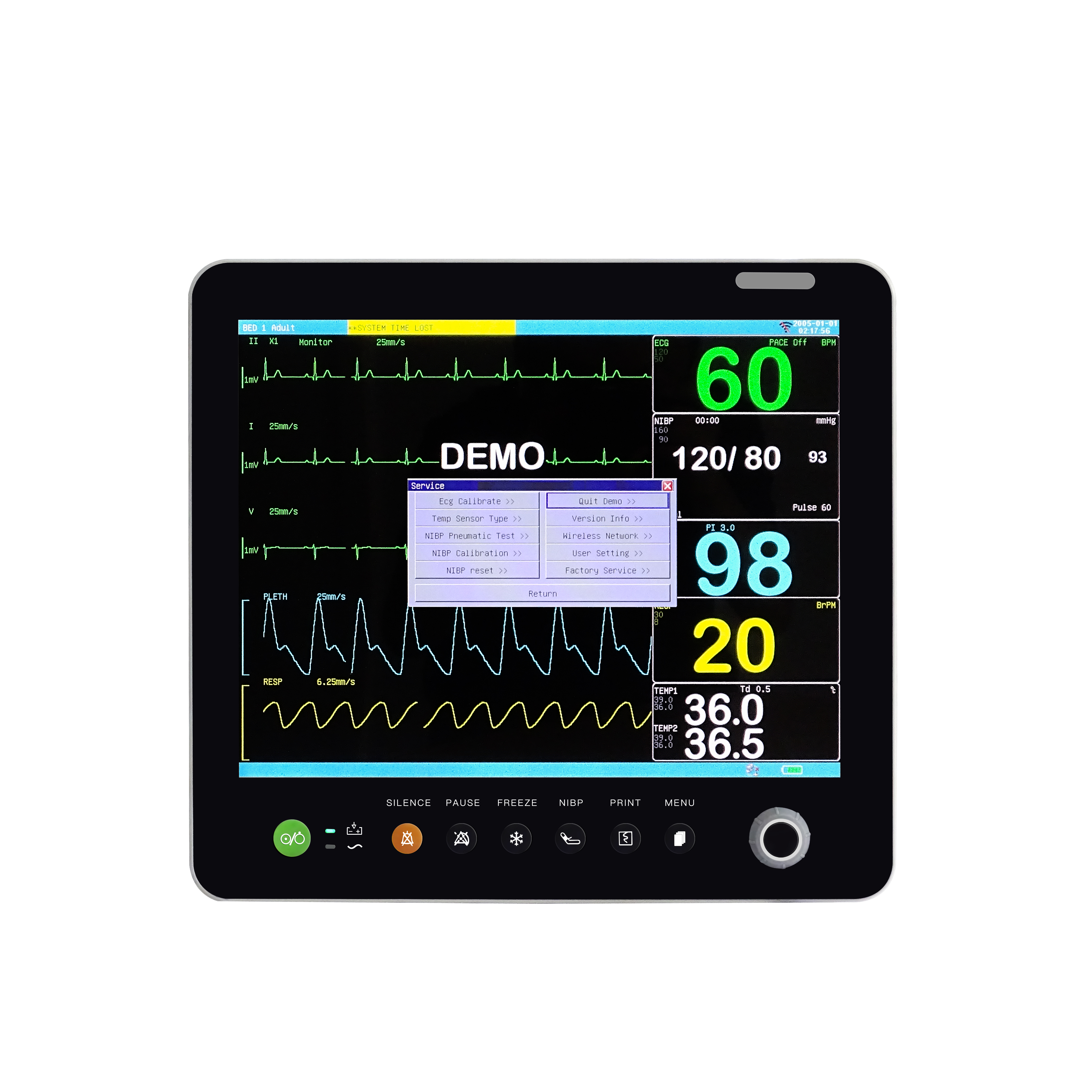 Sistema Inteligente de Monitoreo Intraoperatorio IOM-5