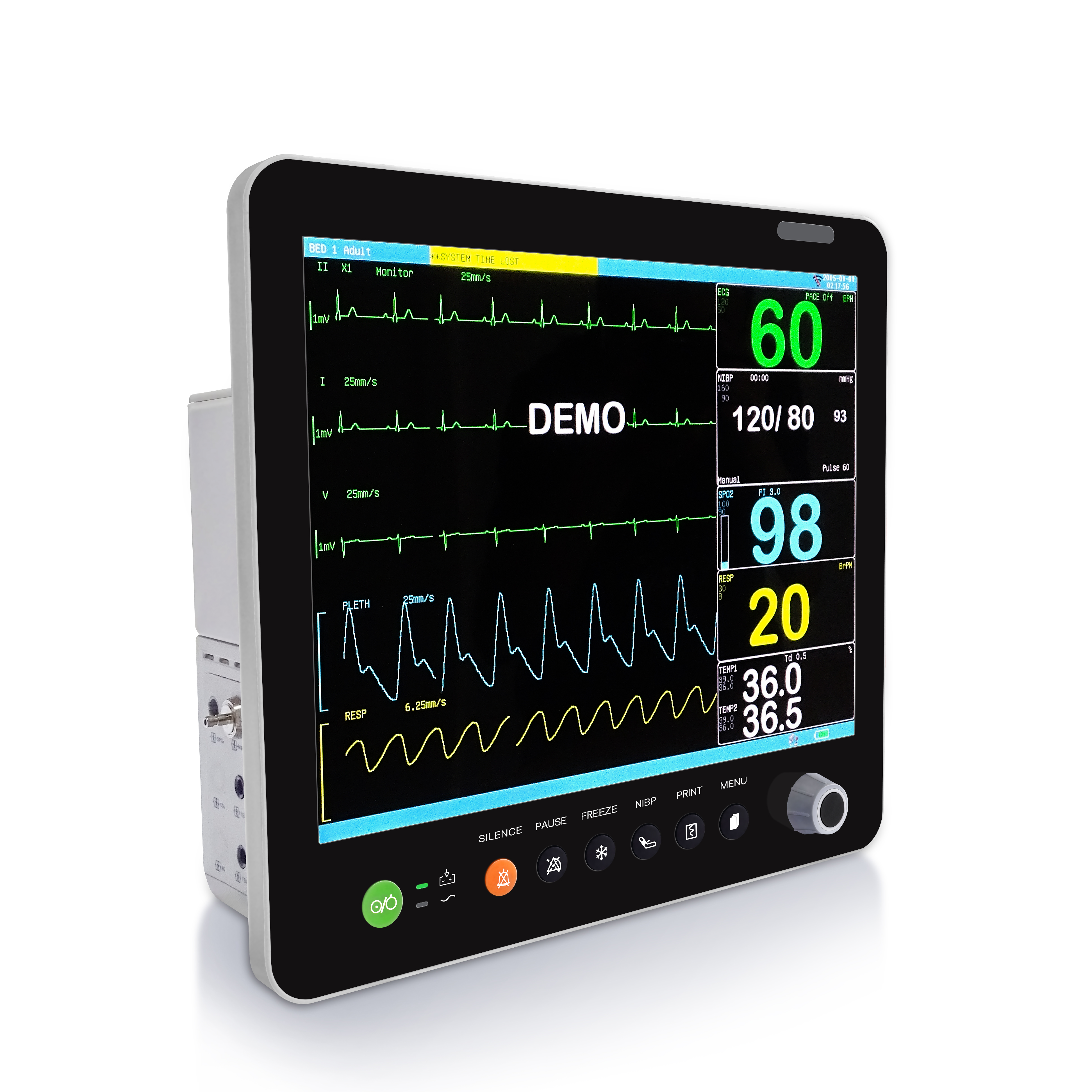 Sistema Inteligente de Monitoreo Intraoperatorio IOM-1