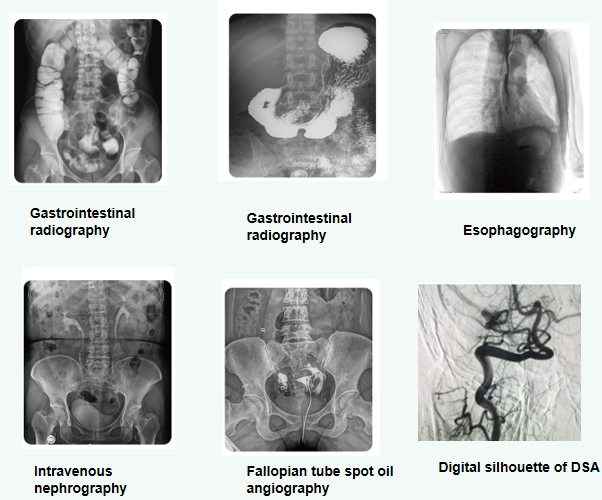 Sistema de Rayos X DR Gastrointestinal Din&aacute;mico de 50 kW, 500 mA y 380 V-4