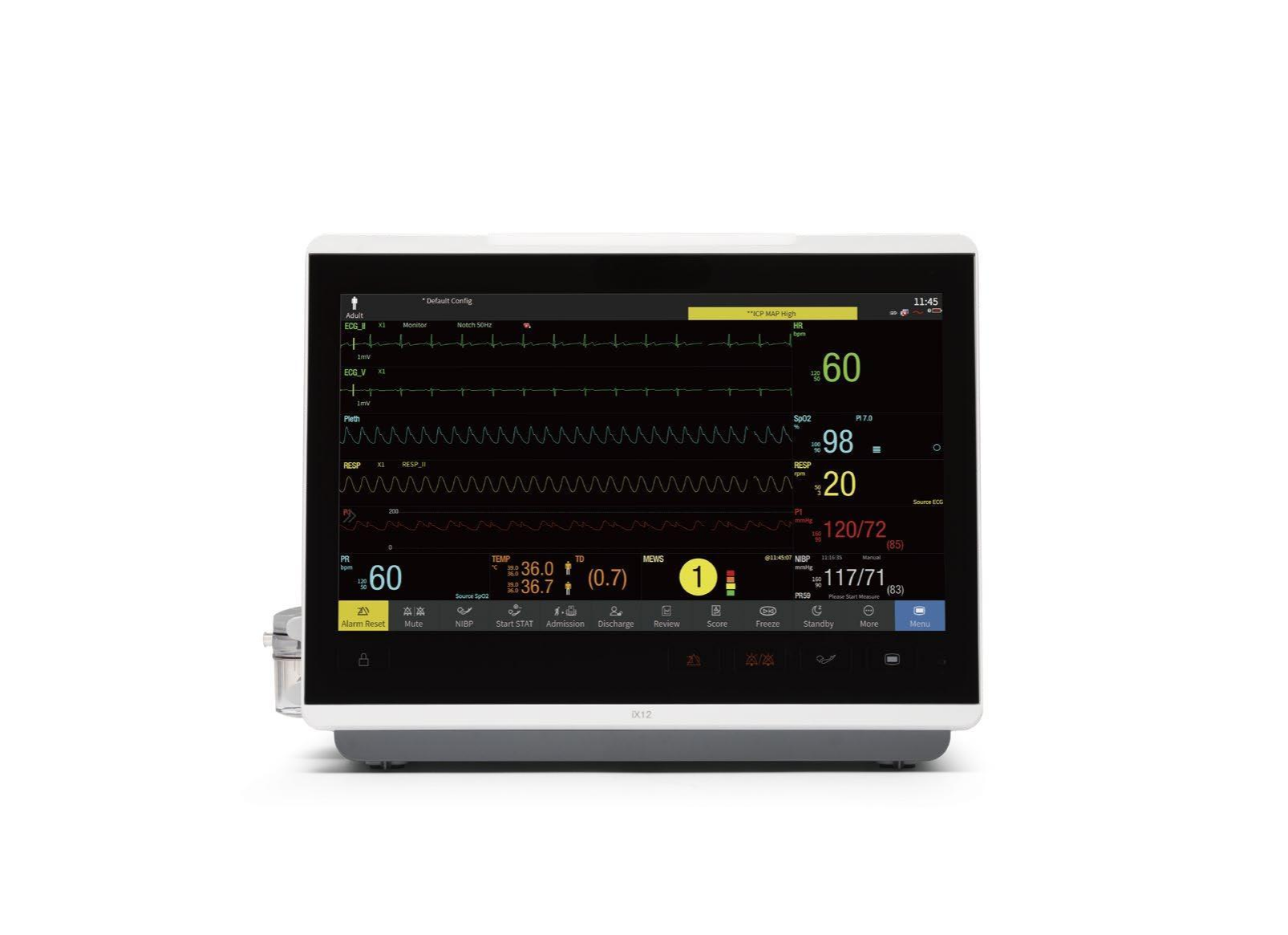 Monitor de paciente de 13,3 pulgadas&nbsp;CCL-DIX12
