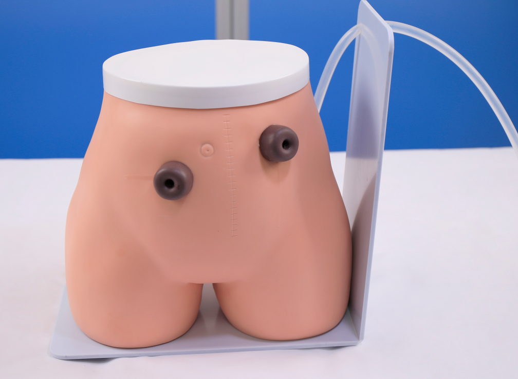 Fistula stoma care model-0