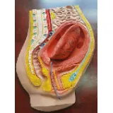 Placental detachment model