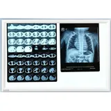 Visor de pel&iacute;culas de rayos X LED &ndash; Doble panel