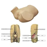 Modelo de entrenamiento de punci&oacute;n del fornix posterior de la vagina