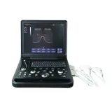 Laptop All-Digital Ultrasound Diagnostic System