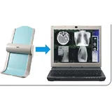 Digitalizador de pel&iacute;culas de rayos X m&eacute;dicas para sistema PACS de radiolog&iacute;a (Esc&aacute;ner de pel&iacute;culas a digital)