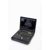 Sistema de diagn&oacute;stico por ultrasonido Doppler de color de 15 pulgadas