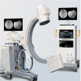 Intensificador de imagen digital C-arm ortop&eacute;dico 5KW Canon, dos monitores LCD de 24"