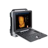 Esc&aacute;ner de ultrasonido veterinario Doppler color digital completo con sonda convexa