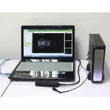 Esc&aacute;ner A/B de ultrasonido oft&aacute;lmico