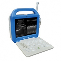 LCD Screen Digital Laptop Ultrasound Scanner