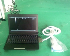 Digital Laptop Ultrasound Scanner