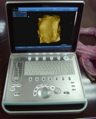 PC based Multi Language Laptop Portable B Ultrasound Scanner
