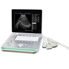 Laptop Portable B Ultrasound Scanner