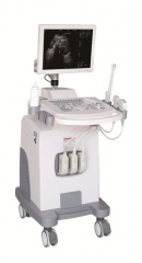 15 inch HD LCD display Full-Digital Trolley Ultrasound Scanner