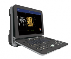 High-end portable 3D 4D Cardiac color Doppler ultrasound