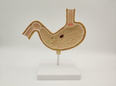 The model of Stomach