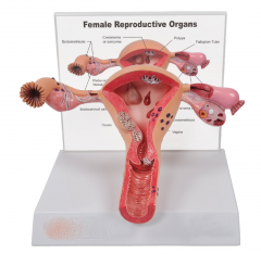 Pathological model of uterus