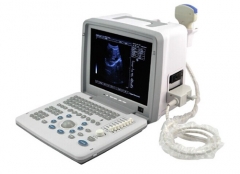 LED Portable Ultrasound Scanner