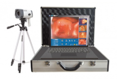 Portable Digital electronic colposcope