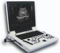 Portable  Ultrasound Scanner(3D software)